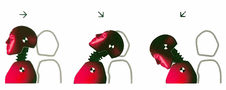 latigazo_cervical.png